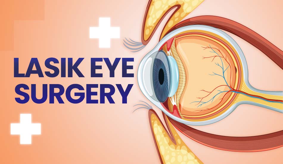 LASIK Eye Surgery: Real Patient Stories and Recovery Tips
